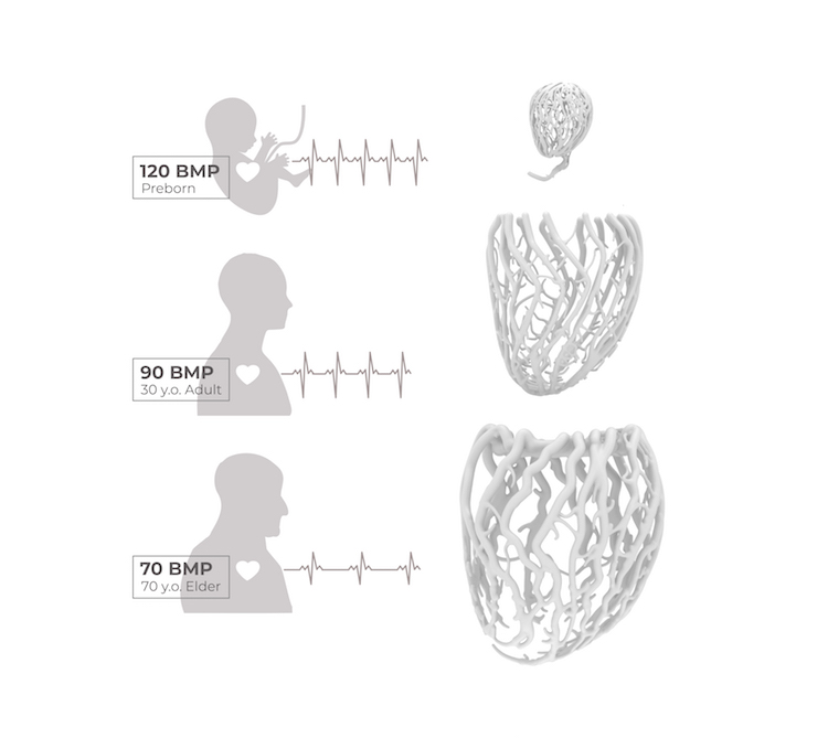 All the lamps are 3D printed and there are three sizes that coincide a preborn heart and a heart of a 30-year-old and an 80-year-old one