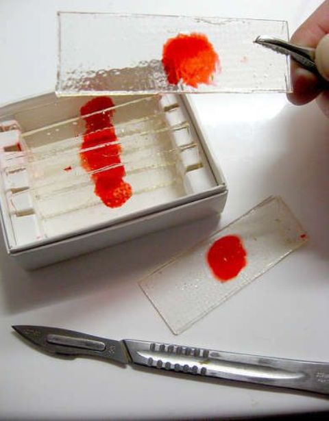 glass pieces with blood samples are inspired by Dexter series and can become nice party favors at your Halloween party